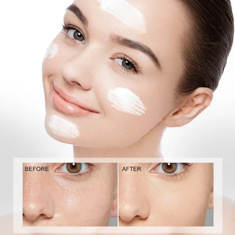Whitening Blemish Clearing Facial Cream